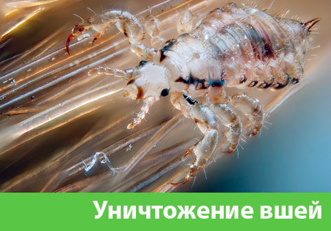 Уничтожение вшей в городе Клинцы